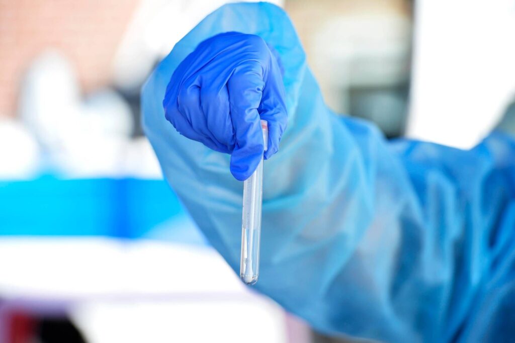 Hantavirus, le bilan : contagion et symptômes, ce qu'il faut savoir et comment se protéger