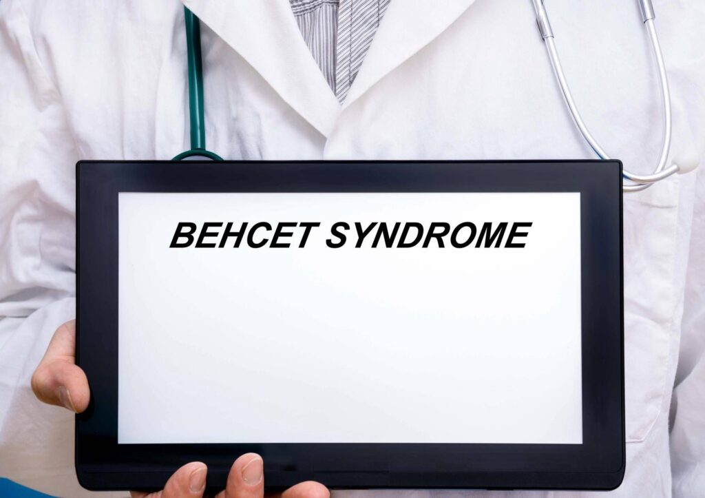 Journée du syndrome de Behçet, expert : "Aujourd'hui, nous pouvons prévenir la cécité"