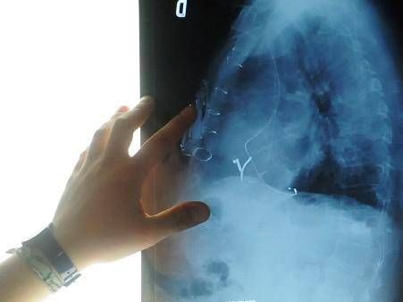 Radiologie interventionnelle, NHS et fondements pour des traitements plus accessibles
