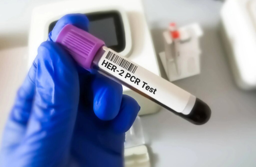 Cancer gastro-œsophagien Her2+, résultats positifs pour le tislelizumab avec le zanidatamab et la chimiothérapie