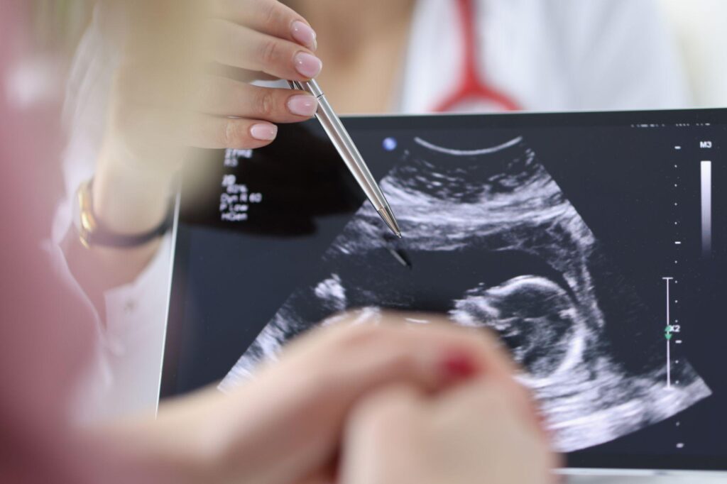 Chirurgie, l'aorte se brise et est opérée avec le bébé dans l'utérus, opération record à Milan