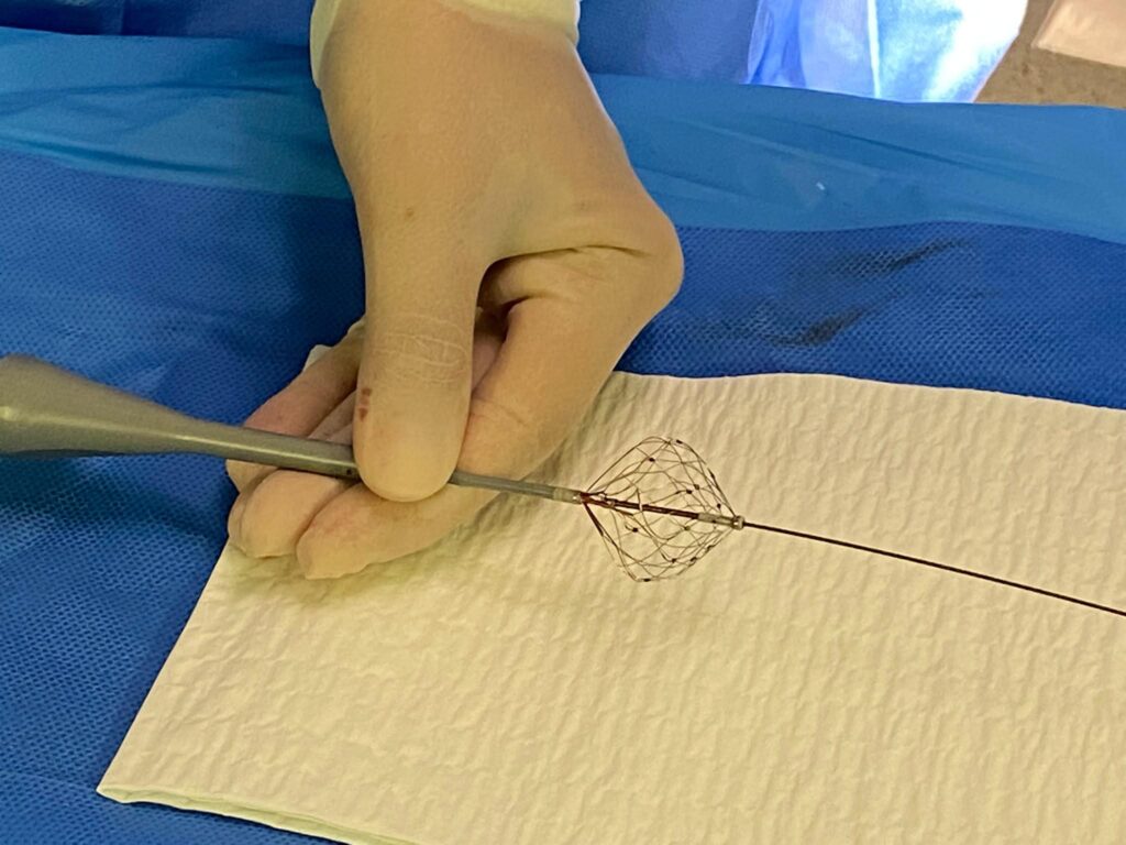 Fibrillation auriculaire, Aou Marche : "Première ablation en Italie avec cathéter à champ pulsé"