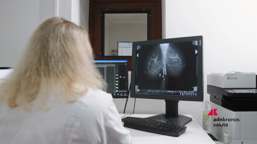Tumeurs: à Milan, l'accent est mis sur les tests génomiques et les pistes thérapeutiques du cancer du sein