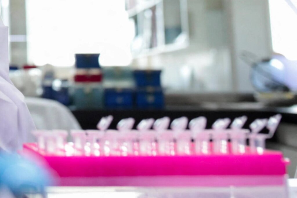 Milan, épidémie de tuberculose à l'Institut de médecine légale : 8 cas confirmés et 7 positifs. Enquêtes sur l'origine de l'infection