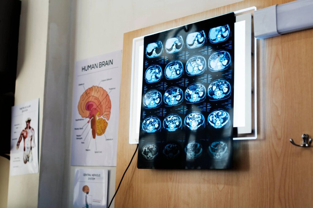 Chirurgie, opération du cerveau avec un patient éveillé : congrès Sinch à Catane