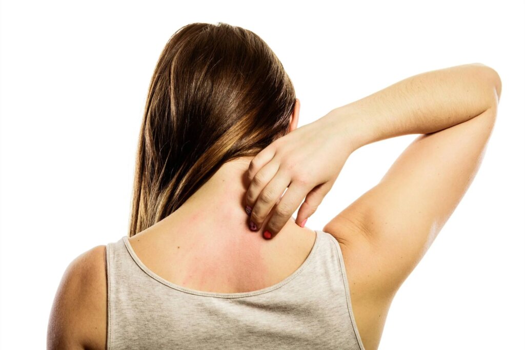Lymphome cutané à cellules T, expert : "Diagnostic difficile en raison de symptômes dermatologiques"