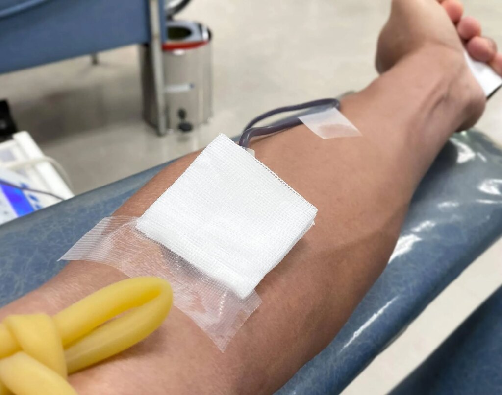 Urgence sanguine en Italie, c'est pourquoi le groupe positif 0 manque en grande partie