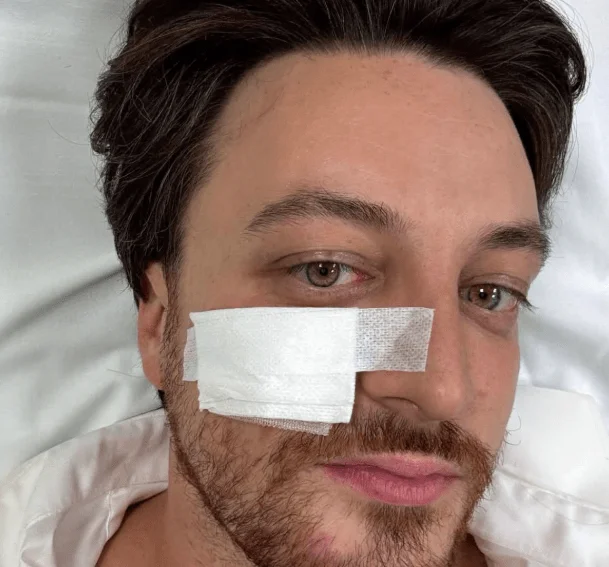 Vénétie, le président Alberto Stefani blessé dans un accident de la route : il se rendait au conseil fédéral de la Ligue à Milan