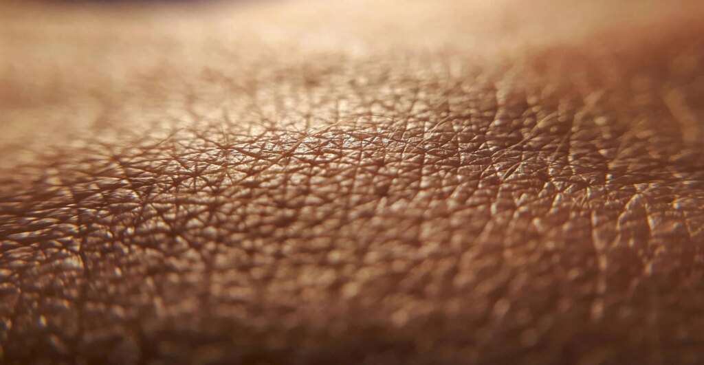 Dermatite atopique, quand la peau conditionne la vie, "Journaux atypiques" donne la parole aux patients