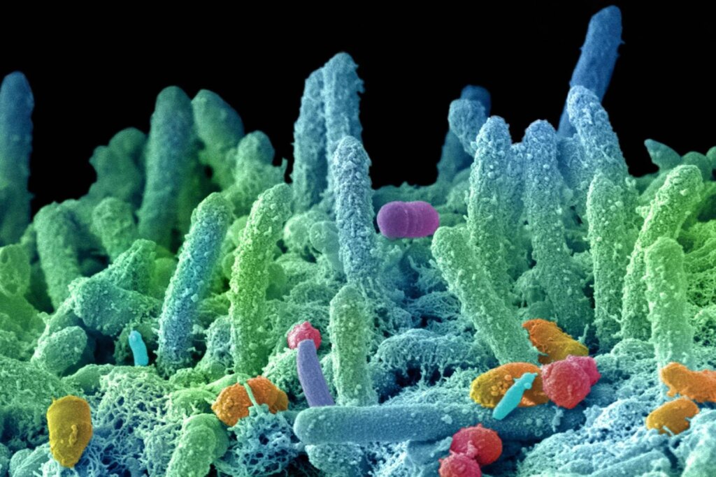 "Nouvelle pandémie de super bactéries", lancent les microbiologistes: certains fonds dans les politiques budgétaires et environnementales