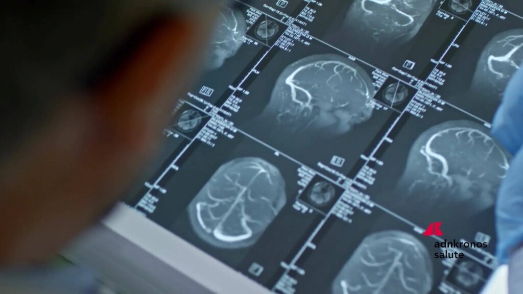 Phénylcétonurie, « le dépistage néonatal évite les dommages neurologiques mais la continuité des soins est nécessaire »